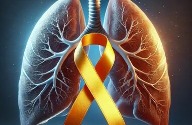 Augmentation préoccupante des cancers du poumon et du pancréas chez les femmes en 2023